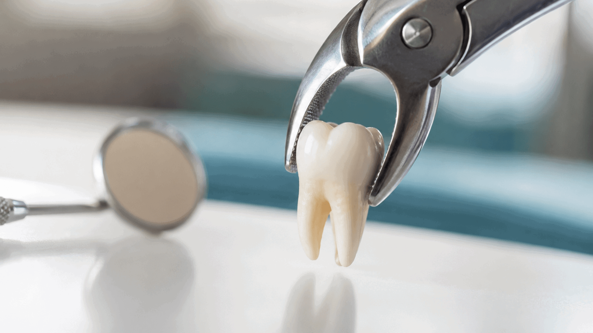Tooth Extraction Cost in San Antonio
