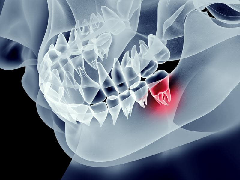 Dental X-ray and exam